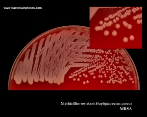 mrsa colonies on blood agar